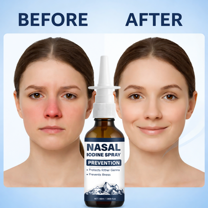 Iodine Nasal Spray